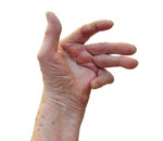 Enfermedades por aparatos. Huesos, articulaciones y músculos. Esclerosis sistémica Enfermedades por aparatos. Huesos, articulaciones y músculos. Esclerosis sistémica