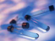 Enfermedades por aparatos. Huesos, articulaciones y músculos. Artritis psoriásica Enfermedades por aparatos. Huesos, articulaciones y músculos. Artritis psoriásica