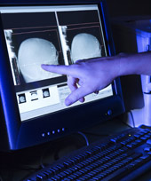 Enfermedades por aparatos. Huesos, articulaciones y músculos. Enfermedad de Paget Enfermedades por aparatos. Huesos, articulaciones y músculos. Enfermedad de Paget